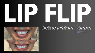 lip flip filler for lips in dallas texas